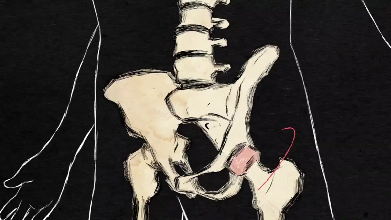 Crutch screenshot 2