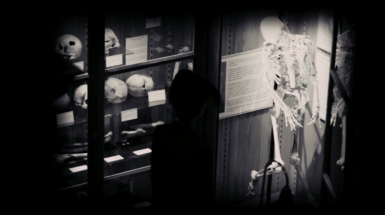 Through the Weeping Glass: On the Consolations of Life Everlasting (Limbos & Afterbreezes in the Mütter Museum) screenshot 2